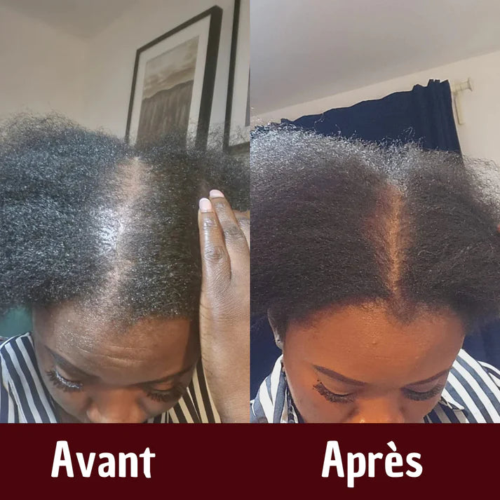 Huile de Batana Brute 100 % Pure 🇧🇯